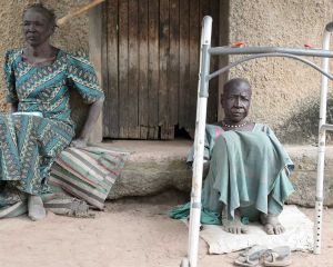 Zwei Frauen im Lepra-Dorf in Agok, die zum Überleben auf die Hilfe anderer Menschen angewiesen sind.